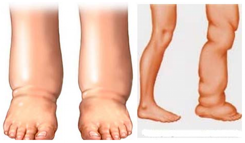 नारायणस्थानमा हात्तिपाइलेको एक प्रतिशतभन्दा कम संक्रमण
