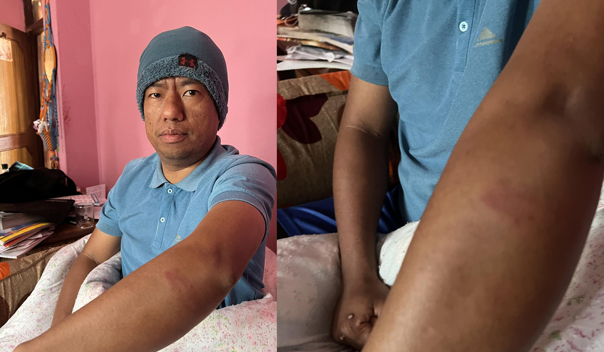 पत्रकार कुटिएको घटनाको छानविन गर्न ५ सदस्य समिति गठन